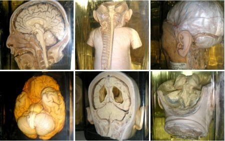 Piezas anatómicas de la morgue judicial 18 1 sistema nervios central