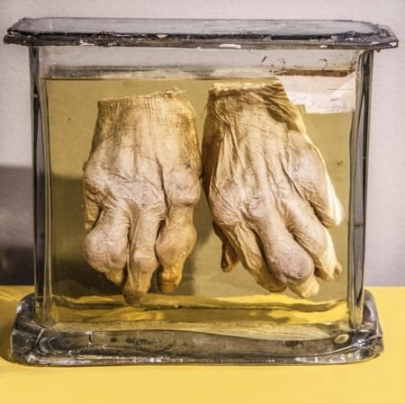 Piezas anatómicas de la morgue judicial 9 Piezas anatómicas de la morgue judicial