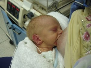 Sindrome alcoholico fetal caracteristicas32