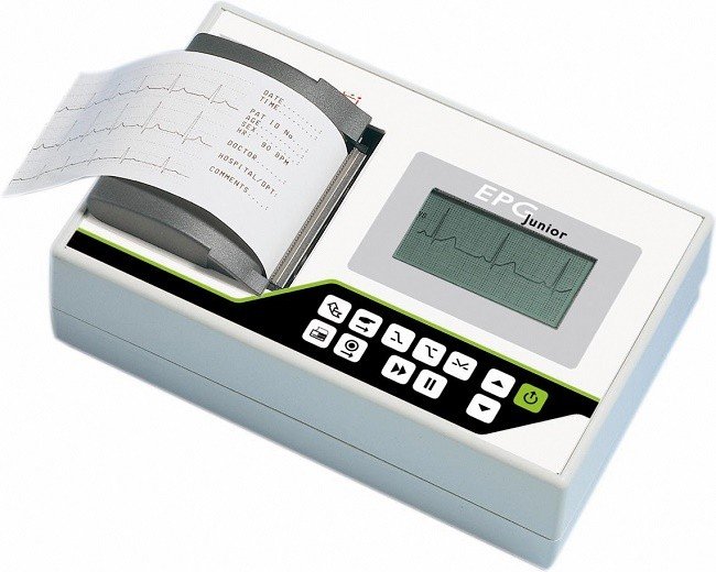 Fibrilación Auricular Que es 2 Electrocardiografo portatil