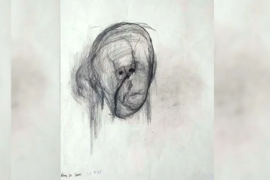 La enfermedad de Alzheimer