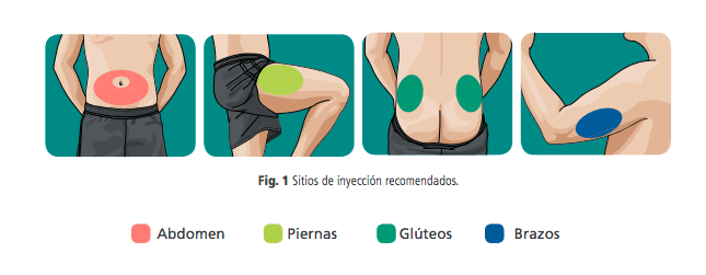 Tipos de Insulina Nombres 4 Conceptos claves de la insulina