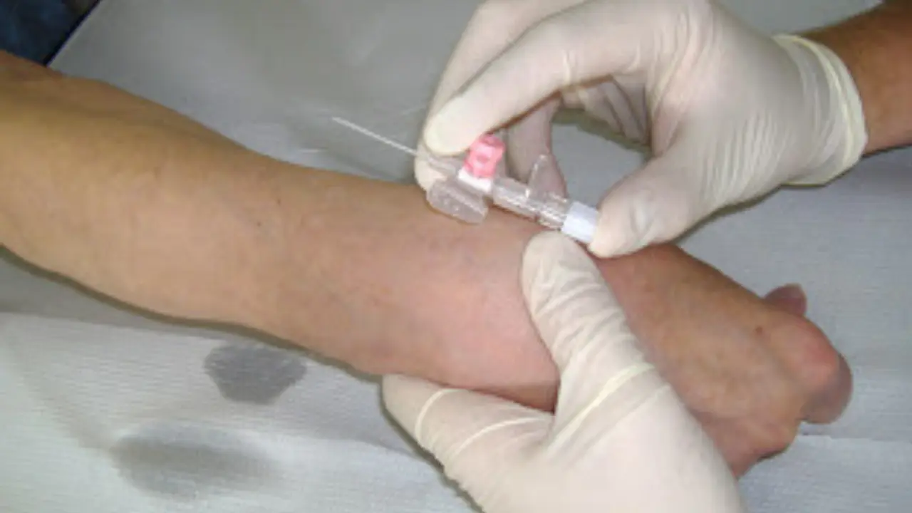 Técnica perfecta para colocar una vía 2 Técnica perfecta para colocar una vía