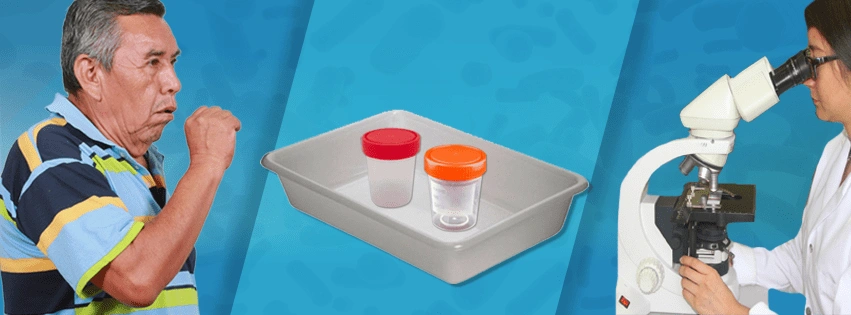 Hisopado para SARG-CoV-2 y muestras laboratorio Vías Aéreas 3 Cultivo de expectoración espontánea. Esputo. Imagen 1