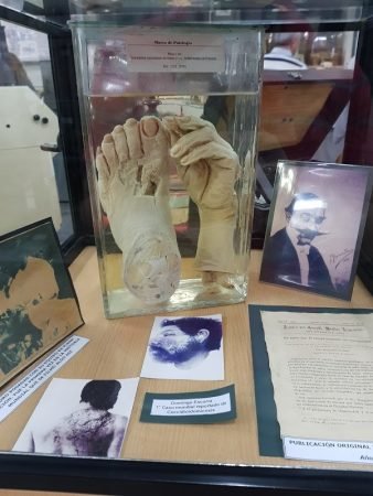 Piezas anatómicas de la morgue judicial