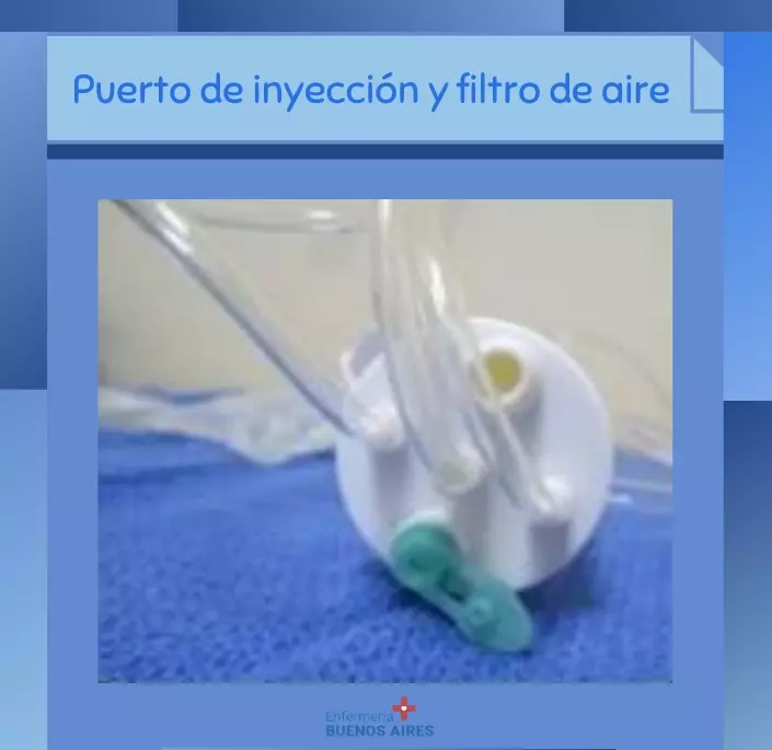 Componentes principales de una venoclisis 7 "Desglose anatómico: Componentes principales de una venoclisis"
