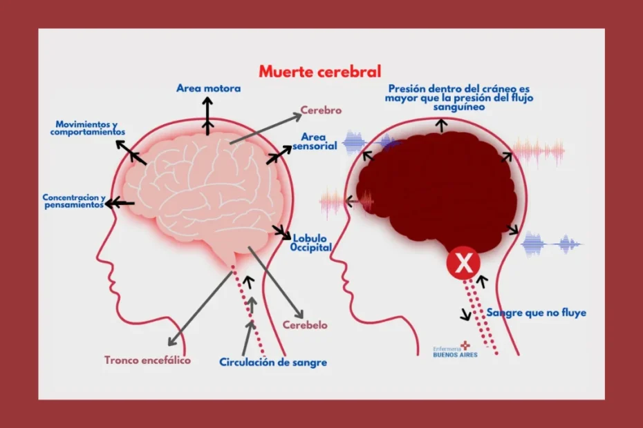 Diferencia entre Muerte Cerebral