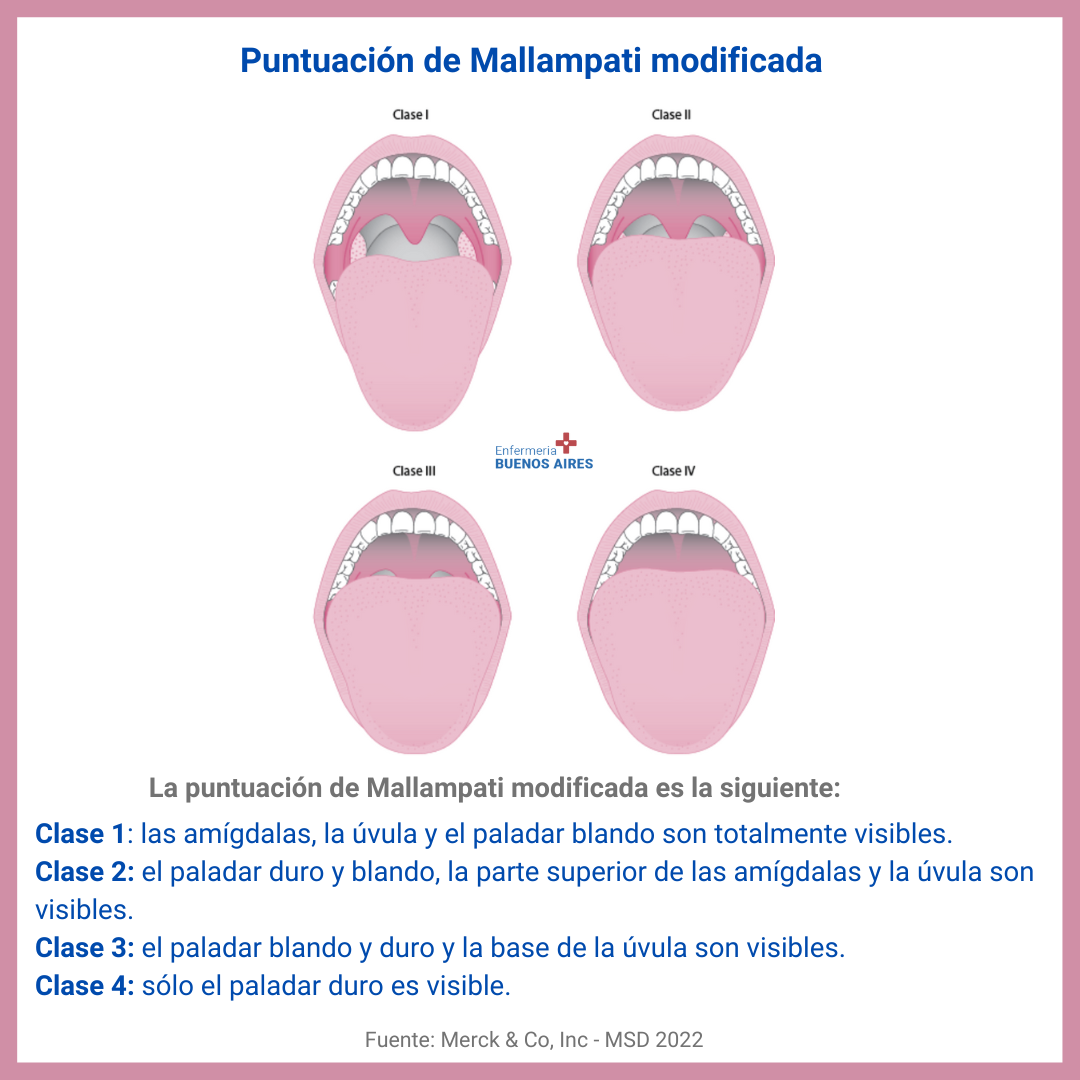 Obesidad e intubación