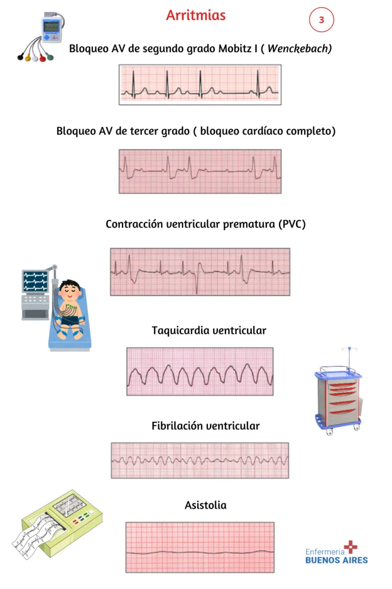 Interpretación de un Electrocardiograma 3 Interpretación de un Electrocardiograma