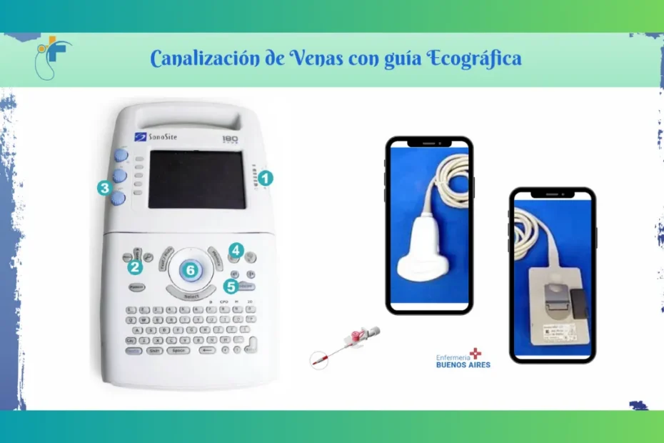 Canalización de Venas con guía Ecográfica