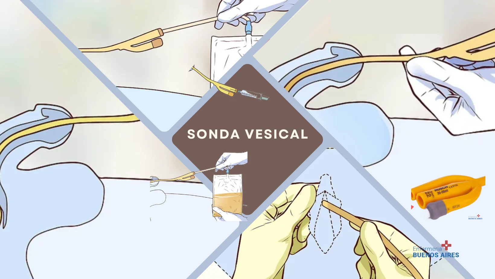 Sonda vesical 3 vias