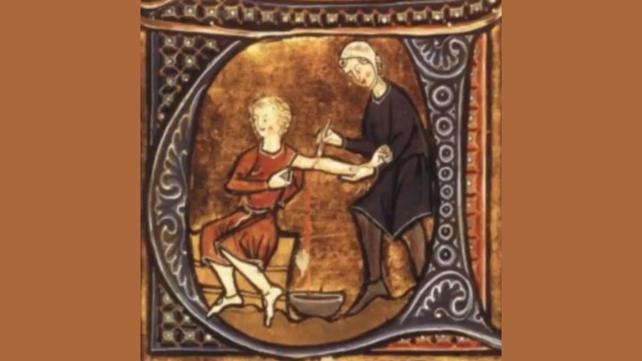 Sangría o Flebotomía: Antiguo Método Curativo de Extracción de Sangre 1 Sangría - Métodos curativos