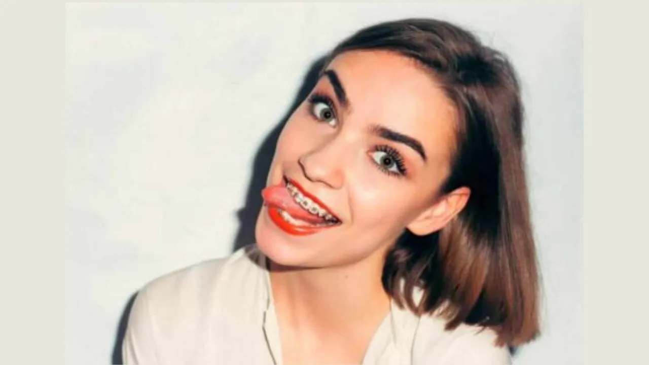Invisalign Argentina 5 Brackets