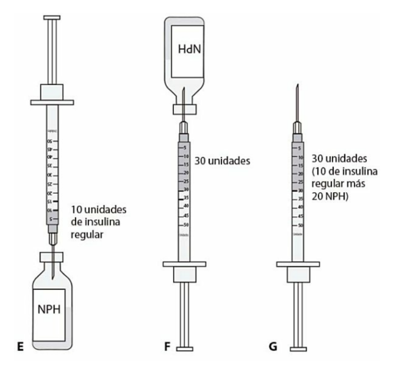 Pasos Para Combinar Insulinas 2024 0780