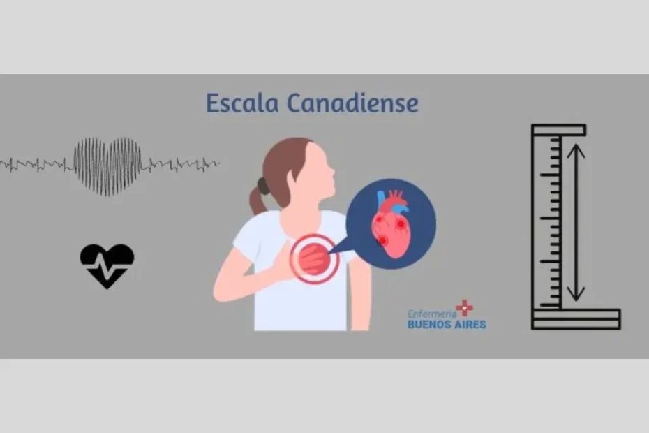 Escala Canadiense