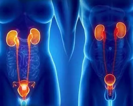 Urología